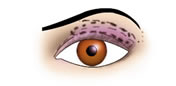 Maquillaje de Ojos Hundidos - Fig.2