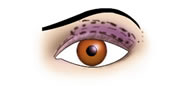 Maquillaje de Ojos Hundidos - Fig.3